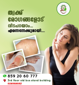 ayurveda chikitsalayam kasaragod. best ayurvedic treatment centre kasaragod.
